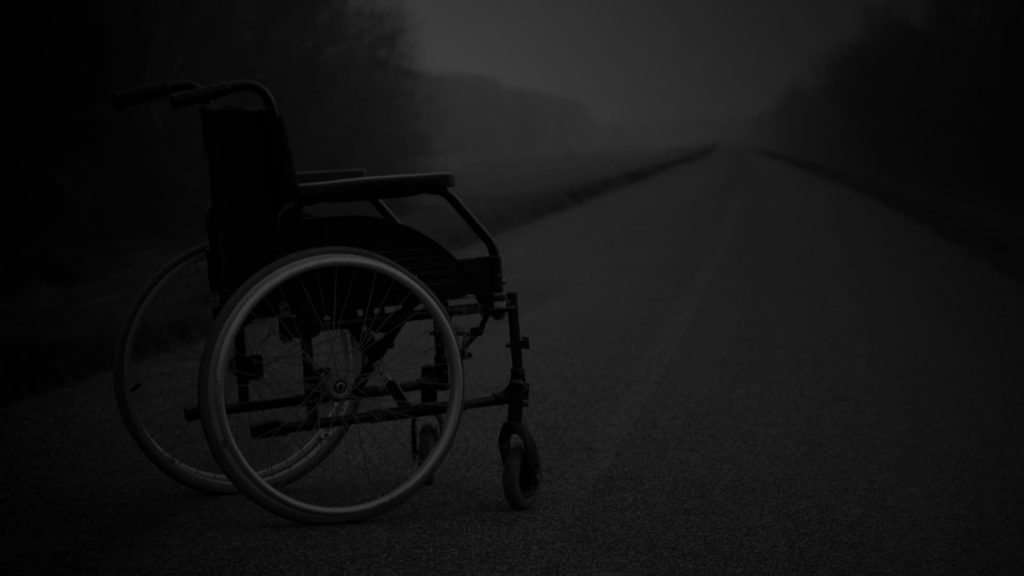 Amputation Injury Attorney